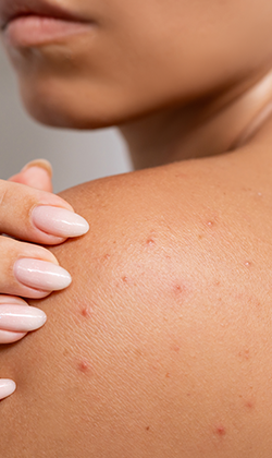 効果について01