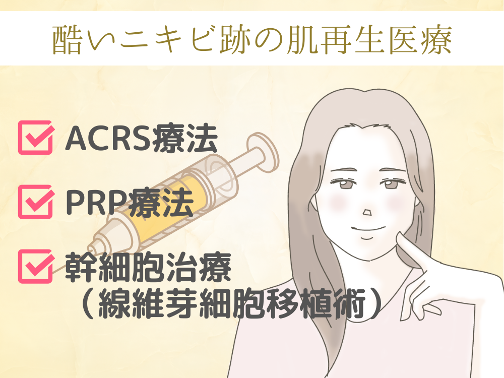 ひどいニキビ跡の肌再生医療
