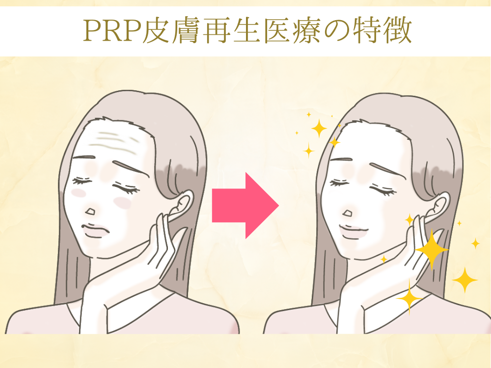PRP皮膚再生医療の特徴
