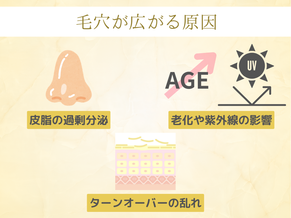 毛穴が広がる原因