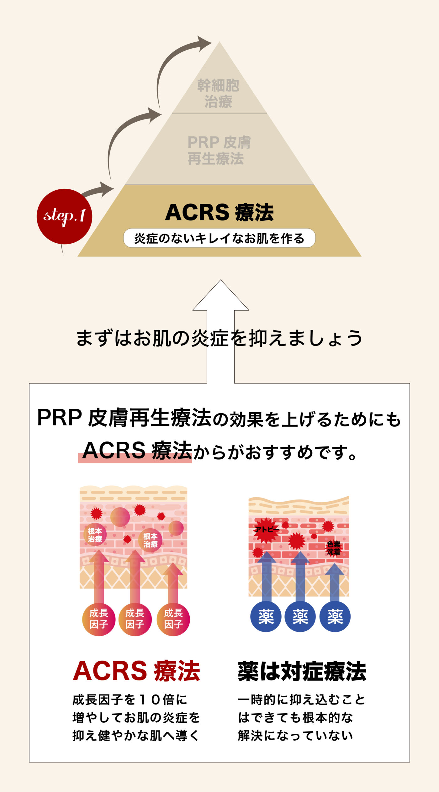 ACRS図sp
