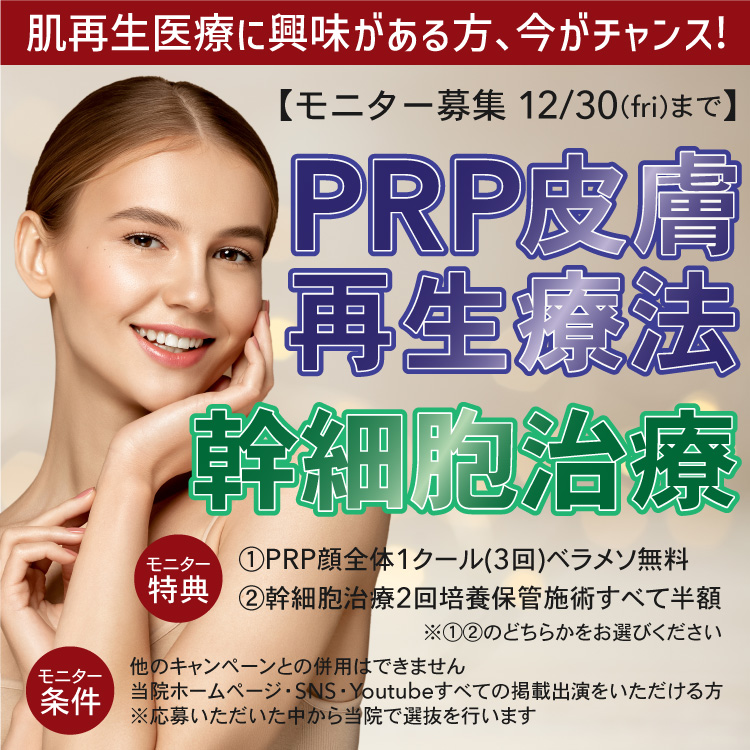 【モニター募集】PRP/幹細胞モニター募集！